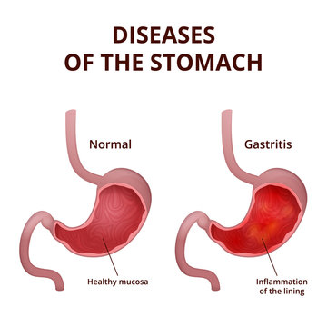 Anatomy of the human stomach