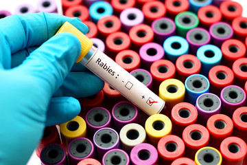 Blood sample positive with rabies virus  - obrazy, fototapety, plakaty