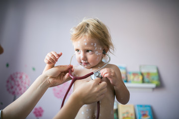 Little girl with chickenpox, antiseptic cream applied to the ras