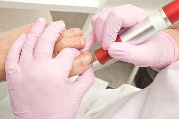 Doctor Podiatry removes calluses, corns and treats ingrown nail. Hardware manicure. Concept body care.
