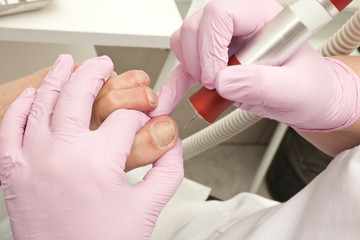 Doctor Podiatry removes calluses, corns and treats ingrown nail. Hardware manicure. Concept body care.
