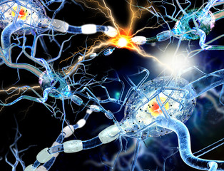 Damaged nerve cells, concept for neurodegenerative and neurological disease, tumors, brain surgery.