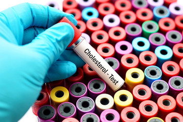 Cholesterol test
