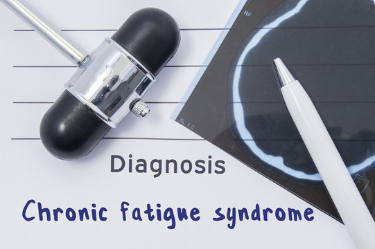 Diagnosis Chronic fatigue syndrome. Written medical report, which indicated neurological diagnosis Chronic fatigue syndrome, surrounded by MRI of brain and reflex hammer on desk in doctor office 