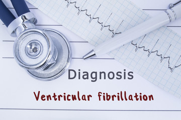 Diagnosis Ventricular fibrillation. Stethoscope or phonendoscope together with type of ECG lie on medical history with title diagnosis Ventricular fibrillation. Medical concept for cardiology 