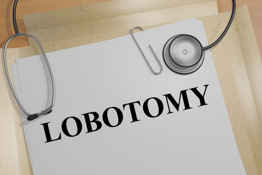 LOBOTOMY - medical concept