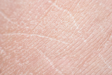 skin texture