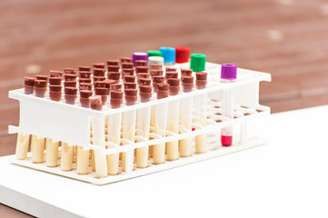 Scientist arrange samples for test in research lab