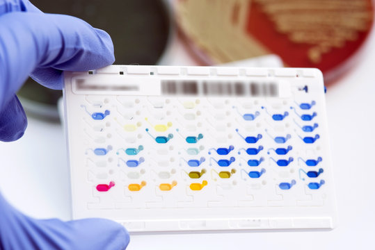 Reagent Strip for biochem and drug sensitivity test for identifi