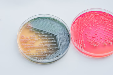 Bacterial colonies culture on  selective agar media XLT Agar (Xy