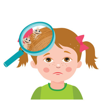 Girl With Lice. Magnifying Glass Close Up Of A Head. Vector Illustration: Dirty Head, Dirty Hair, Infection. Child With Lice. Mud Girl. Hygiene Promotion.