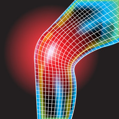 Knee pain ,X-Ray ,Knee Scan