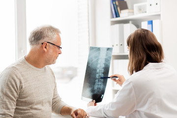 doctor with spine x-ray and senior man at hospital