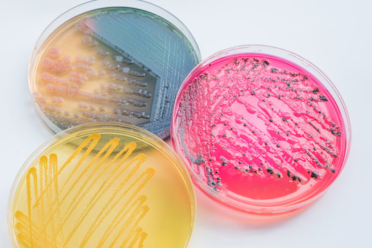 Bacterial colonies culture on  Differential and Selective media
