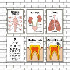 Illustration of medical pictures on a wall