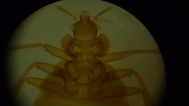 Tick in Microscope