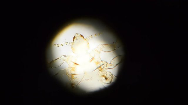 Tick in Microscope