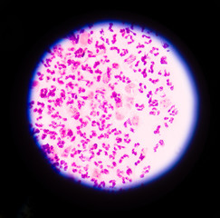  blood smear is often used as a follow-up test to abnormal resul