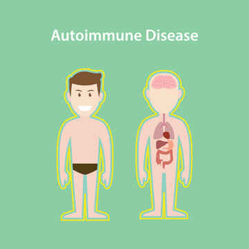 autoimmune disease system illustration with cartoon human man body  protection effect