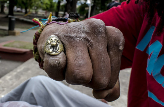 mano con anillo en dedo menique y cicatrices, pu&ntilde;o con pulseras, nudillos,  fotograf&iacute;a a color
