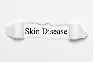 Obraz premium Skin Disease on white torn paper