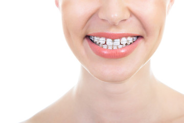 Beautiful macro shot of white teeth with braces. Dental care pho