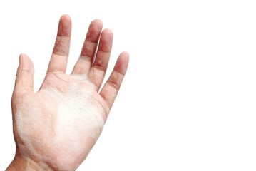 hair loss on hand after taking shower isolated on a white background 