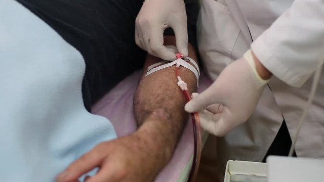The doctor attaches the arm of the patient catheter