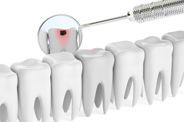 Dental concept, mouth mirror and bad tooth among other, 3D rende