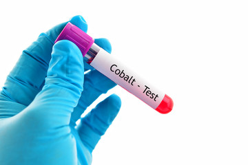 Obraz premium Blood sample for cobalt (Co) test 