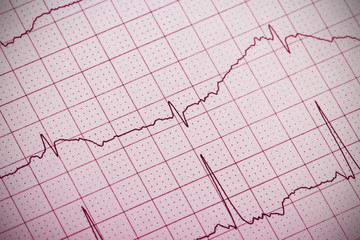 Ecg graph, electrocardiogram ecg