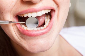 Fototapeta premium dentistry, dental , mouth and teeth close up smiling