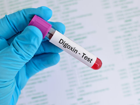 Blood sample for digoxin (drug for heart disease) level test

