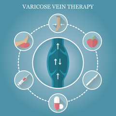 Infographics phlebology, treating varicose veins on women's legs. Varicose vein icons.