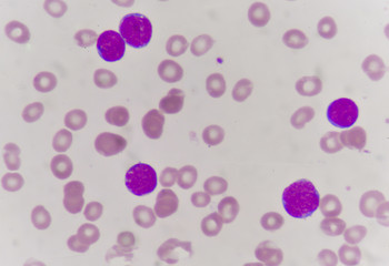 blood smear
