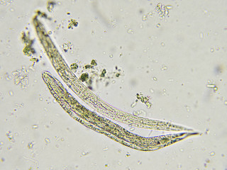 Strongyloides stercoralis (threadworm) in stool, analyze by microscope
