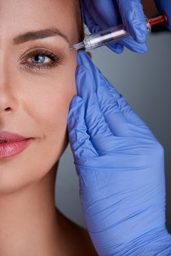 middle age woman on botox treatment