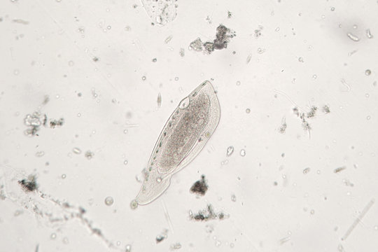 Freshwater zooplankton probably protozoan ciliated Ciliophora or Turbellaria