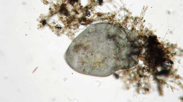 Stentor or trumpet animalcules is filter-feeding, heterotrophic protozoan ciliate
