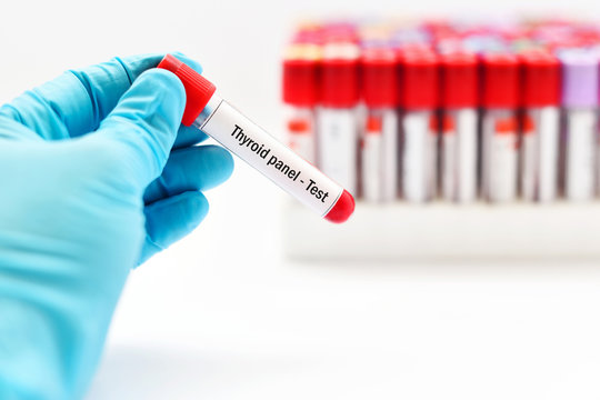 Blood for thyroid panel test