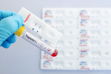 Troponin I testing by using rapid test cassette 
