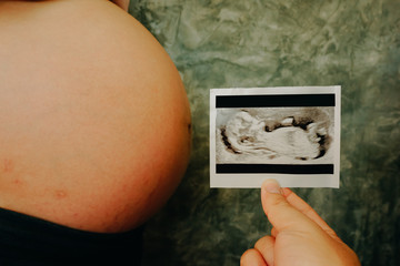 Pregnant Woman Holding Ultrasound Scan Photo