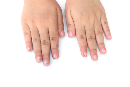 Children long nails isolated on white background.Children dirty