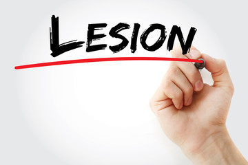 Hand writing Lesion with marker, concept background