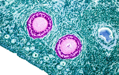 Ovarian follicles. Light microscopy, hematoxylin and eosin stain, magnification 200x. Colors are...