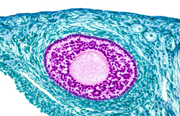Light micrograph of ovary showing follicle. Magnification 100x. Colors are enhanced for better...