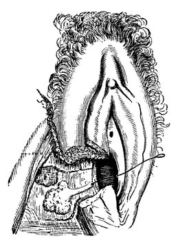 Human Vulvovaginal Glands, vintage engraving
