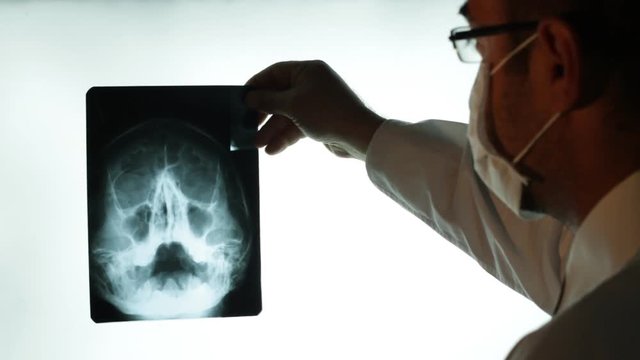 Doctor reviewing hand x-rays print. Male doctor examining X ray image