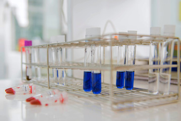 blood in test tubes and investigation form in laboratory.