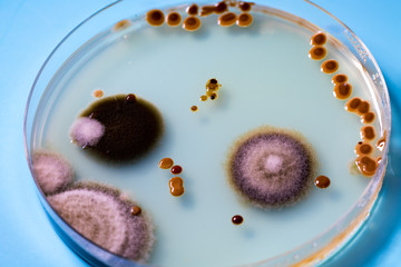 Bacteria colonies on petri dishes